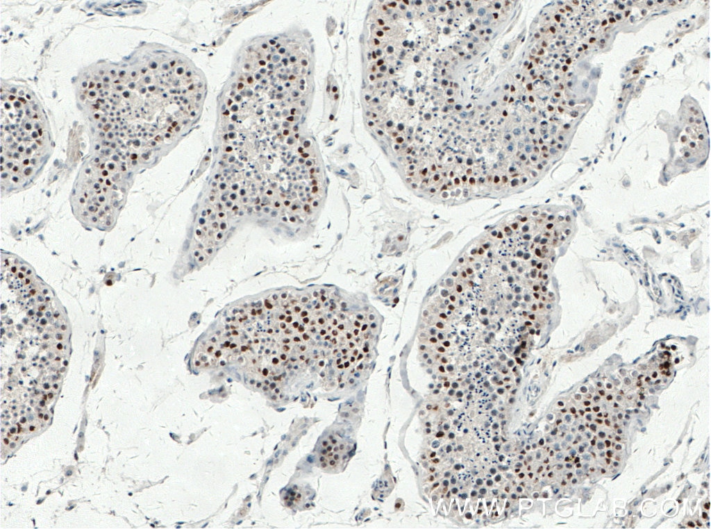 Immunohistochemistry (IHC) staining of human testis tissue using TP53RK Polyclonal antibody (26818-1-AP)