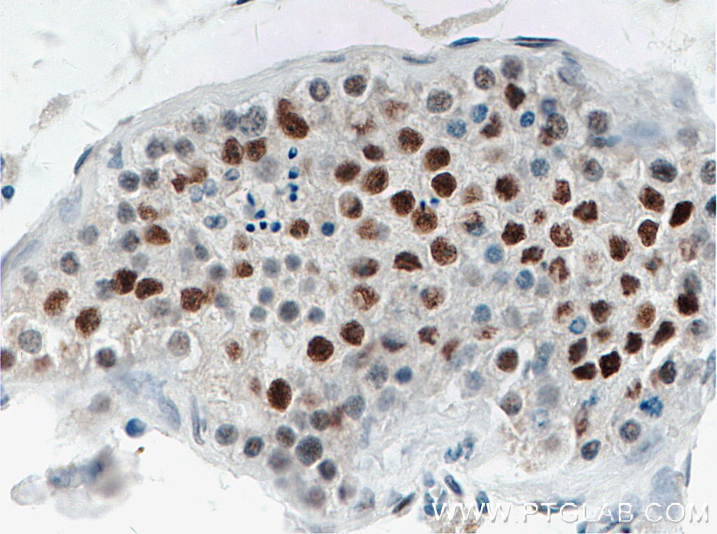 Immunohistochemistry (IHC) staining of human testis tissue using TP53RK Polyclonal antibody (26818-1-AP)