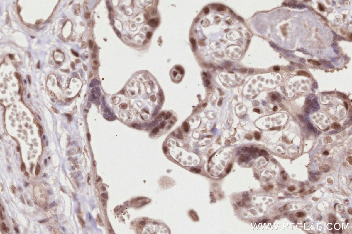 Immunohistochemistry (IHC) staining of human placenta tissue using TP53RK Polyclonal antibody (26818-1-AP)