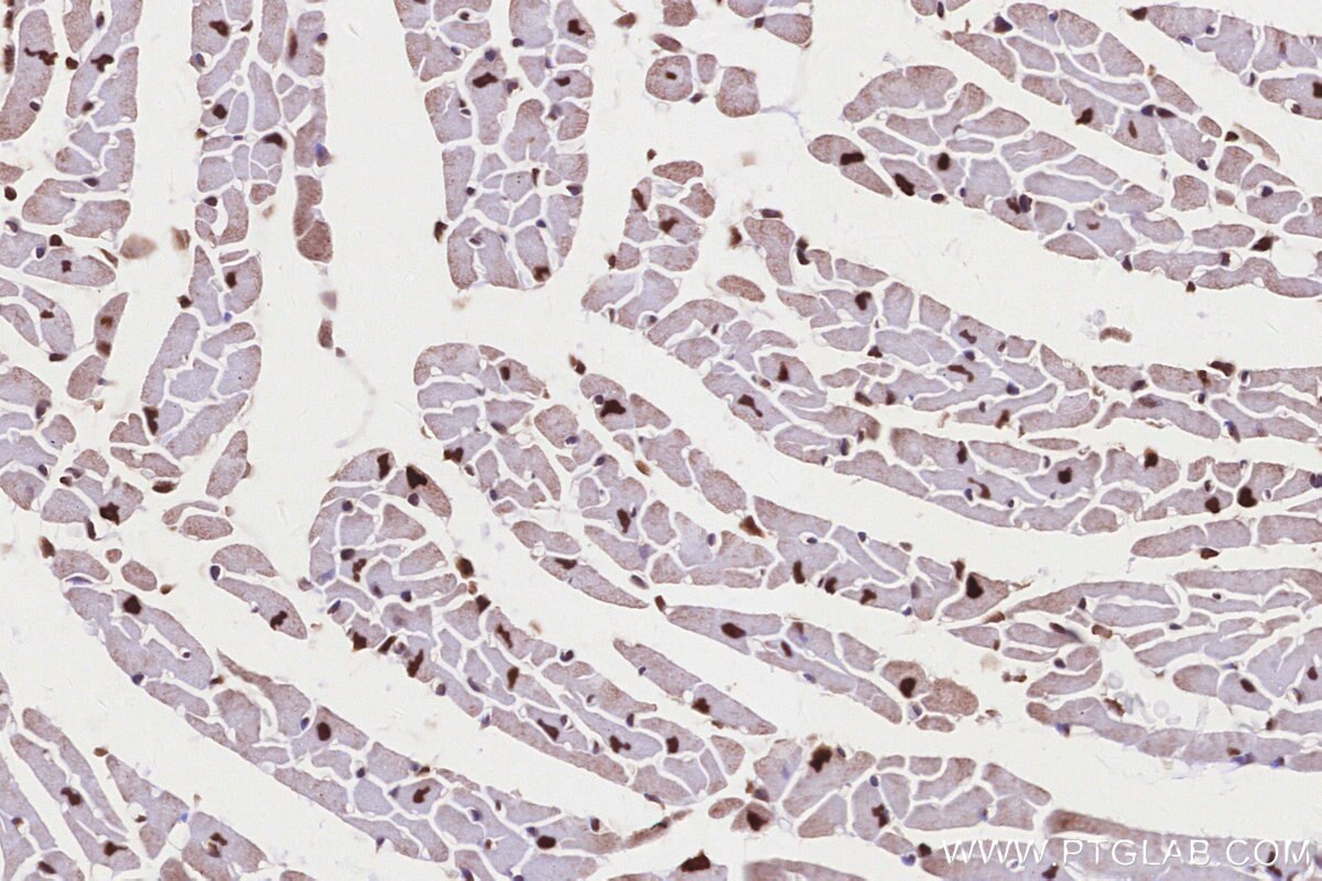 Immunohistochemistry (IHC) staining of mouse heart tissue using TP53RK Polyclonal antibody (26818-1-AP)