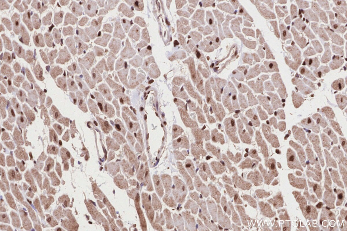 Immunohistochemistry (IHC) staining of rat heart tissue using TP53RK Polyclonal antibody (26818-1-AP)