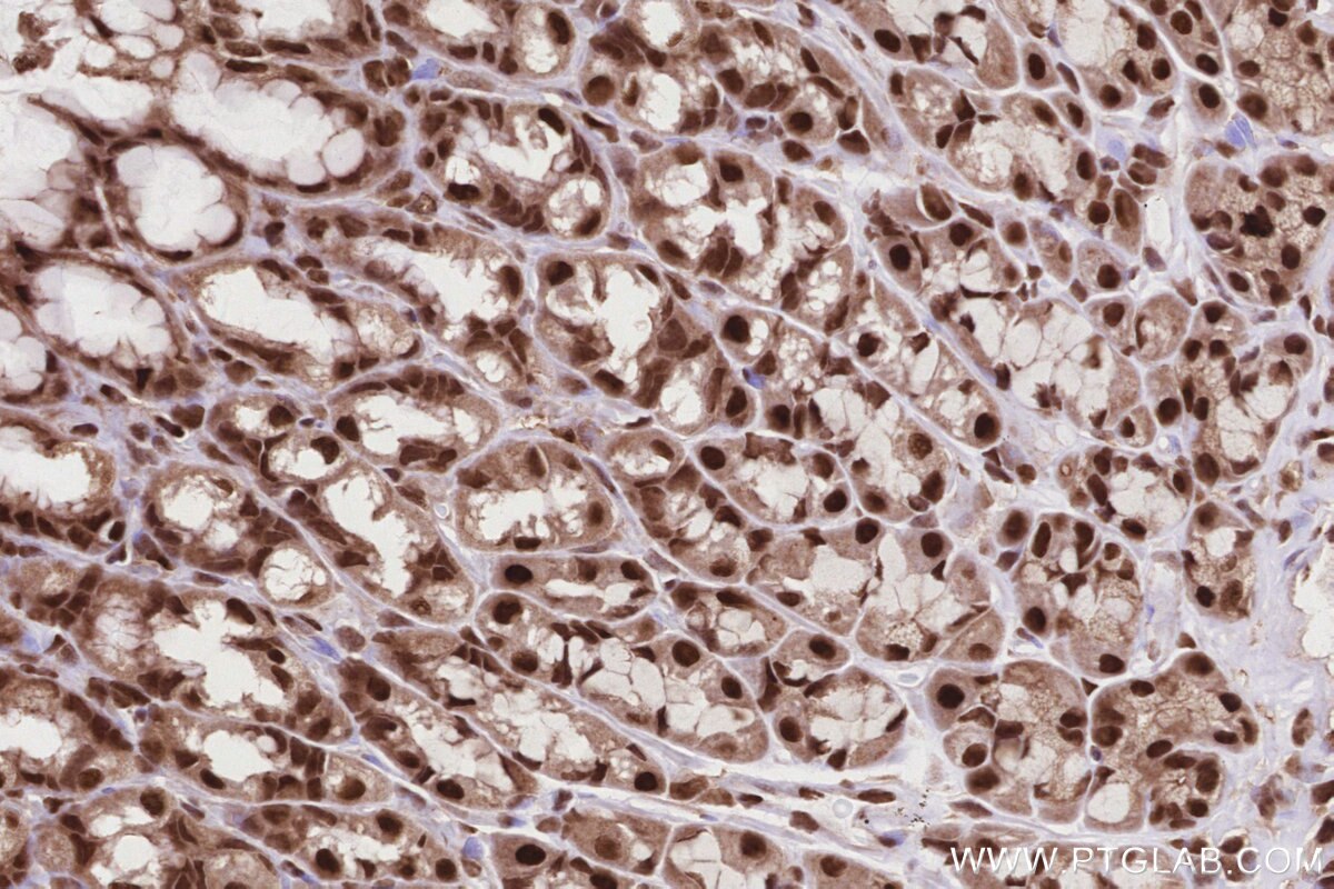 Immunohistochemistry (IHC) staining of rat stomach tissue using TP53RK Polyclonal antibody (26818-1-AP)