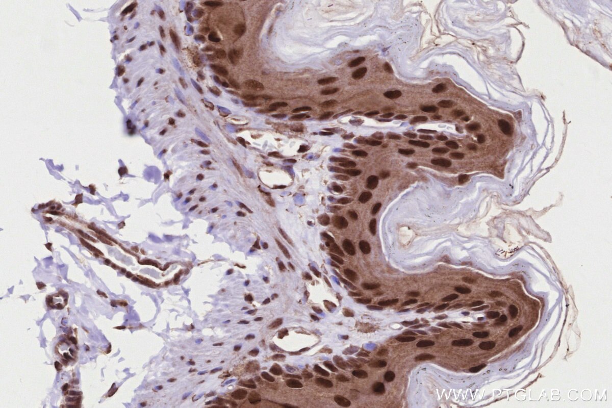 Immunohistochemistry (IHC) staining of mouse stomach tissue using TP53RK Polyclonal antibody (26818-1-AP)