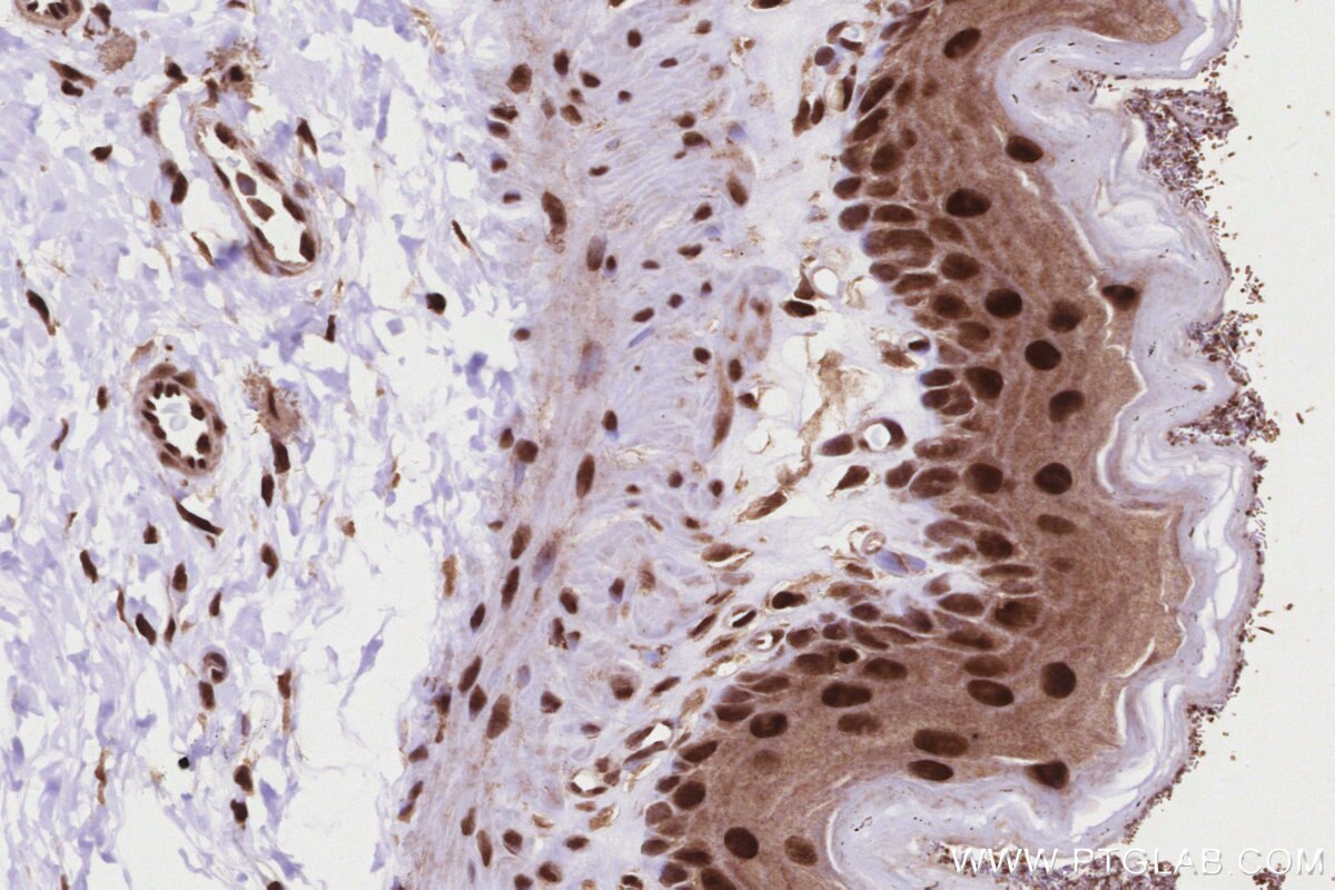 Immunohistochemistry (IHC) staining of rat stomach tissue using TP53RK Polyclonal antibody (26818-1-AP)