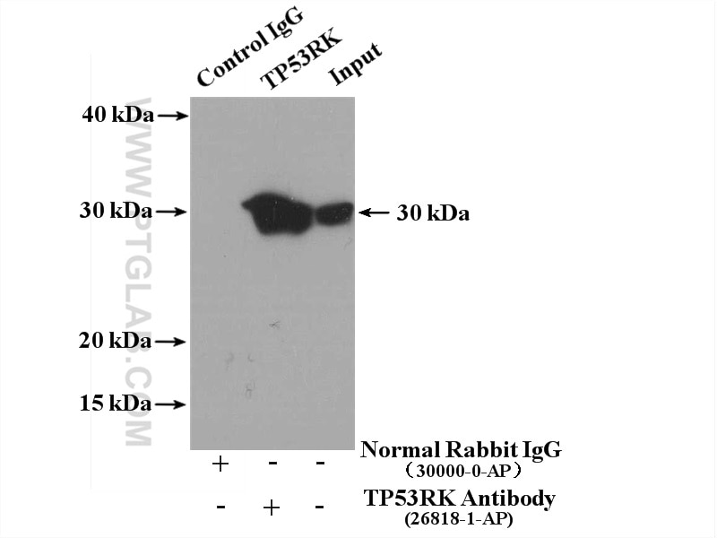Immunoprecipitation (IP) experiment of Jurkat cells using TP53RK Polyclonal antibody (26818-1-AP)
