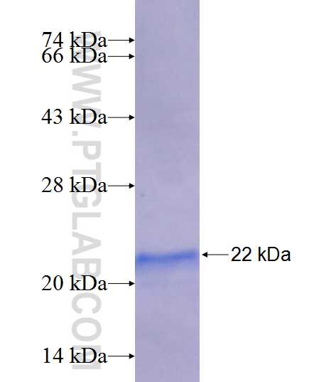 TP53RK fusion protein Ag25326 SDS-PAGE