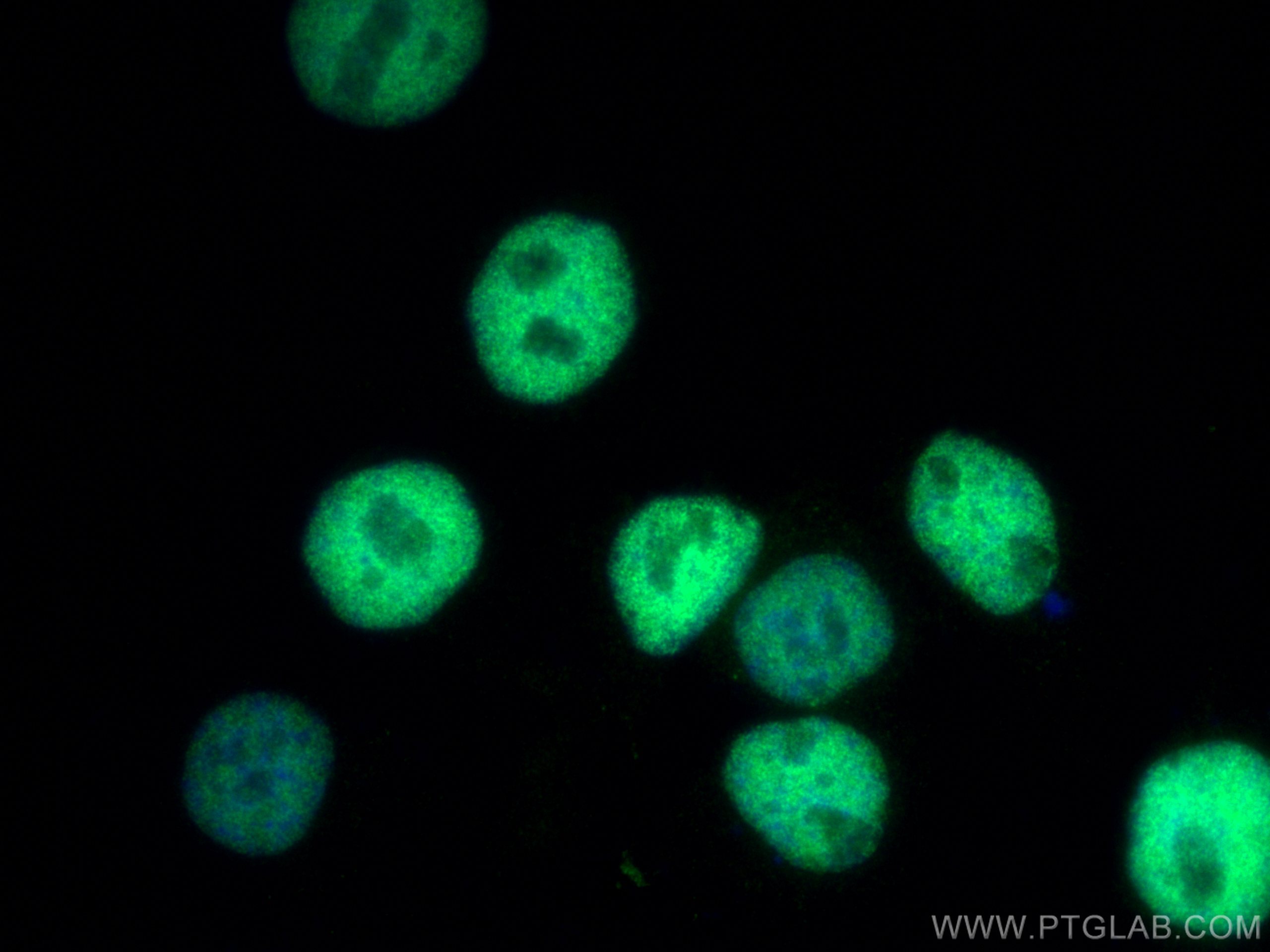 Immunofluorescence (IF) / fluorescent staining of A431 cells using p63 Polyclonal antibody (12143-1-AP)