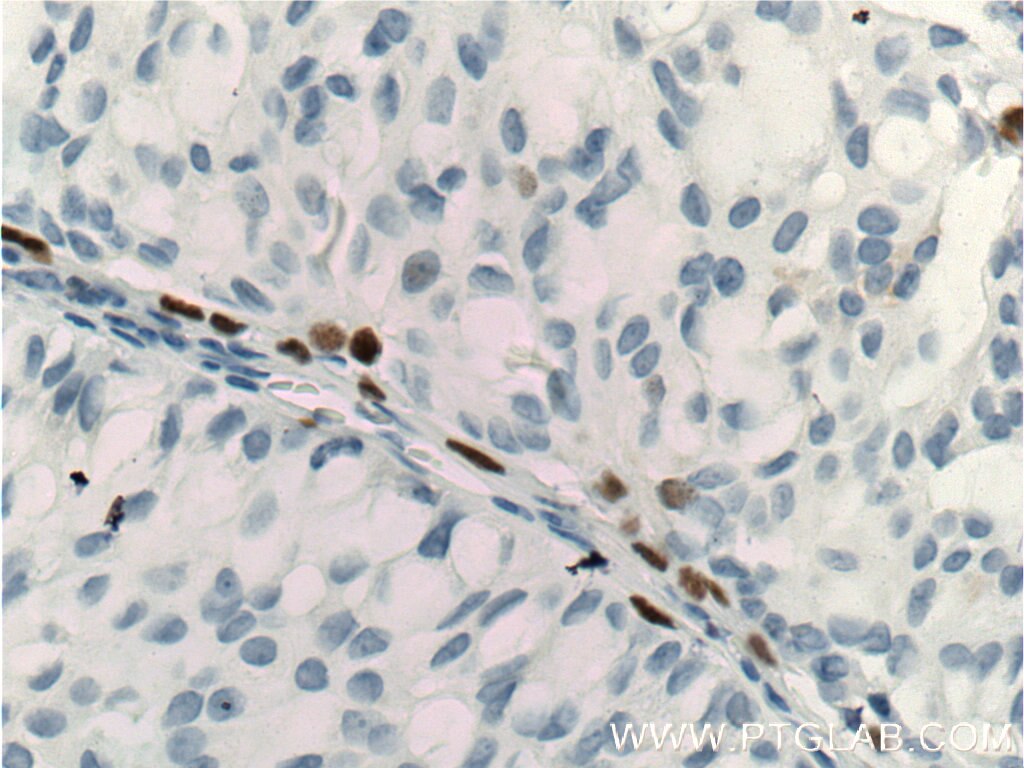 p63 Polyclonal antibody