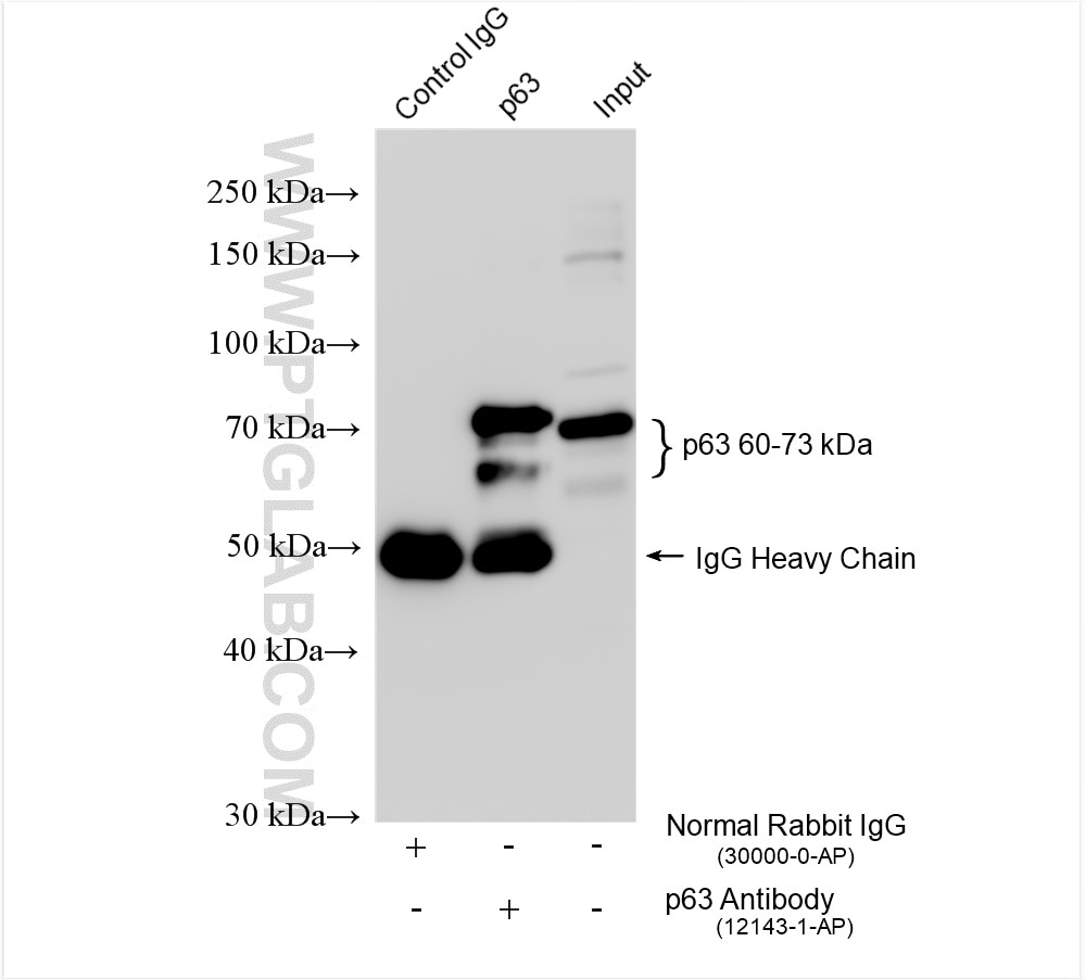 Immunoprecipitation (IP) experiment of A431 cells using p63 Polyclonal antibody (12143-1-AP)