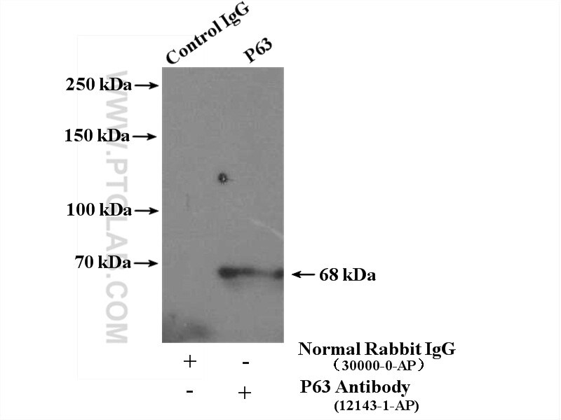 Immunoprecipitation (IP) experiment of A431 cells using p63 Polyclonal antibody (12143-1-AP)