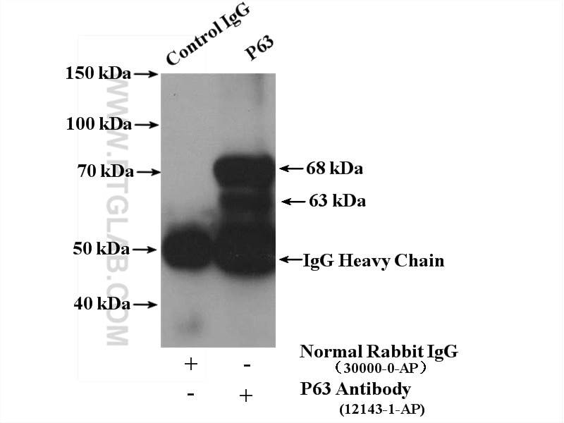 Immunoprecipitation (IP) experiment of A431 cells using p63 Polyclonal antibody (12143-1-AP)