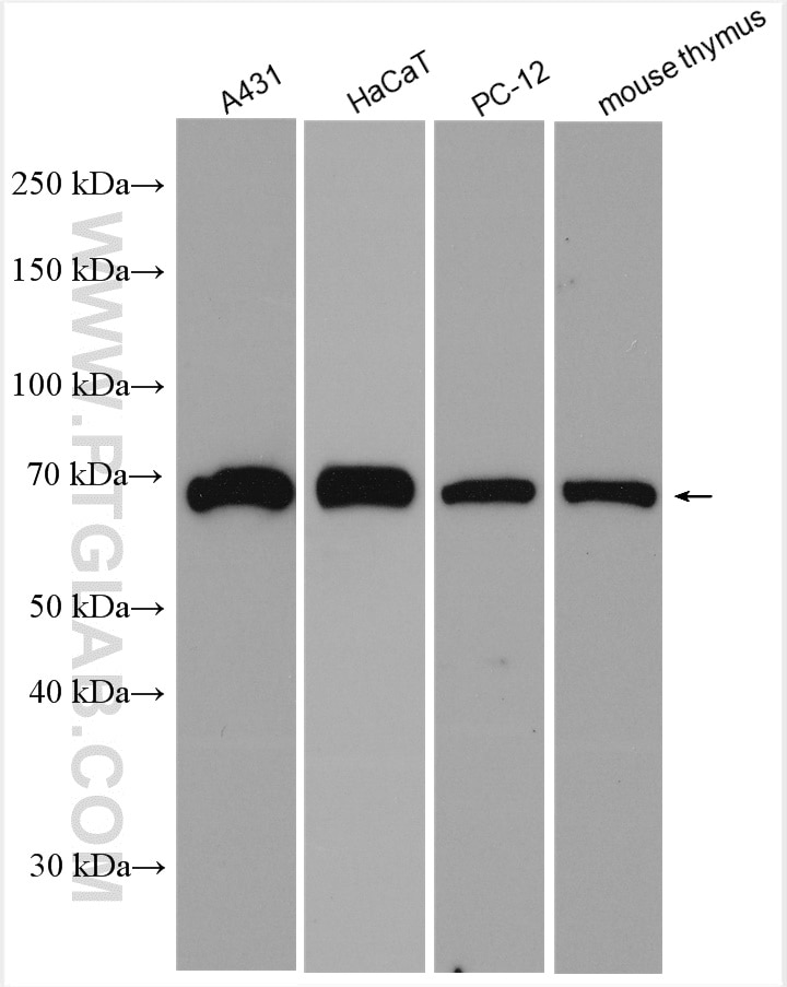 Western Blot (WB) analysis of various lysates using p63 Polyclonal antibody (12143-1-AP)