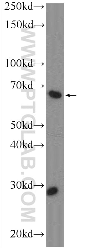 Western Blot (WB) analysis of mouse heart tissue using p63 Polyclonal antibody (12143-1-AP)