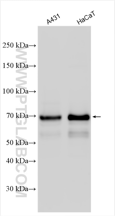 Western Blot (WB) analysis of various lysates using p63 Polyclonal antibody (12143-1-AP)