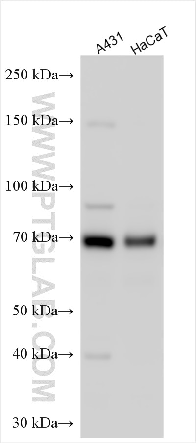 Western Blot (WB) analysis of various lysates using p63 Polyclonal antibody (12143-1-AP)