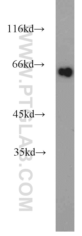 Western Blot (WB) analysis of human heart tissue using p63 Polyclonal antibody (12143-1-AP)