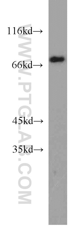 p63 Polyclonal antibody