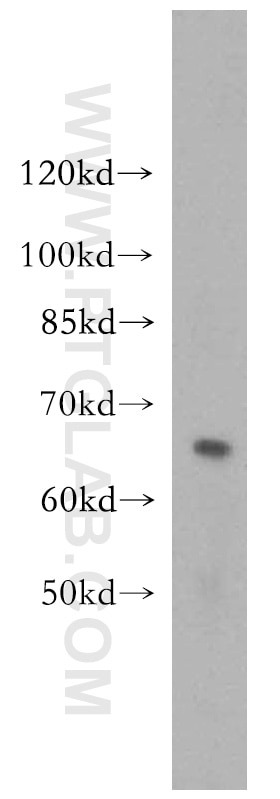 Western Blot (WB) analysis of U-937 cells using p63 Polyclonal antibody (12143-1-AP)