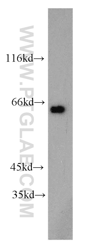Western Blot (WB) analysis of Apoptosised HeLa cells using p63 Polyclonal antibody (12143-1-AP)