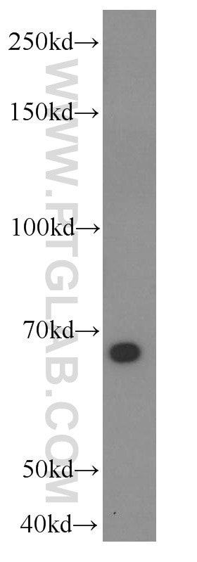 Western Blot (WB) analysis of PC-3 cells using p63 Monoclonal antibody (60332-1-Ig)