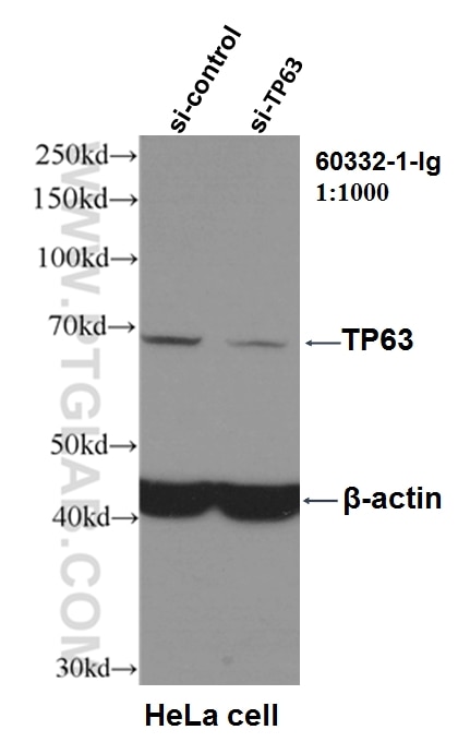 Western Blot (WB) analysis of HeLa cells using p63 Monoclonal antibody (60332-1-Ig)