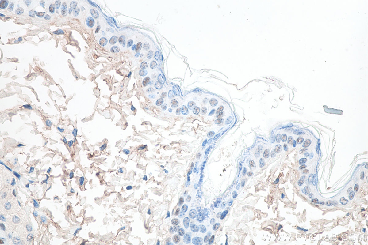 IHC staining of mouse skin using 60332-2-Ig