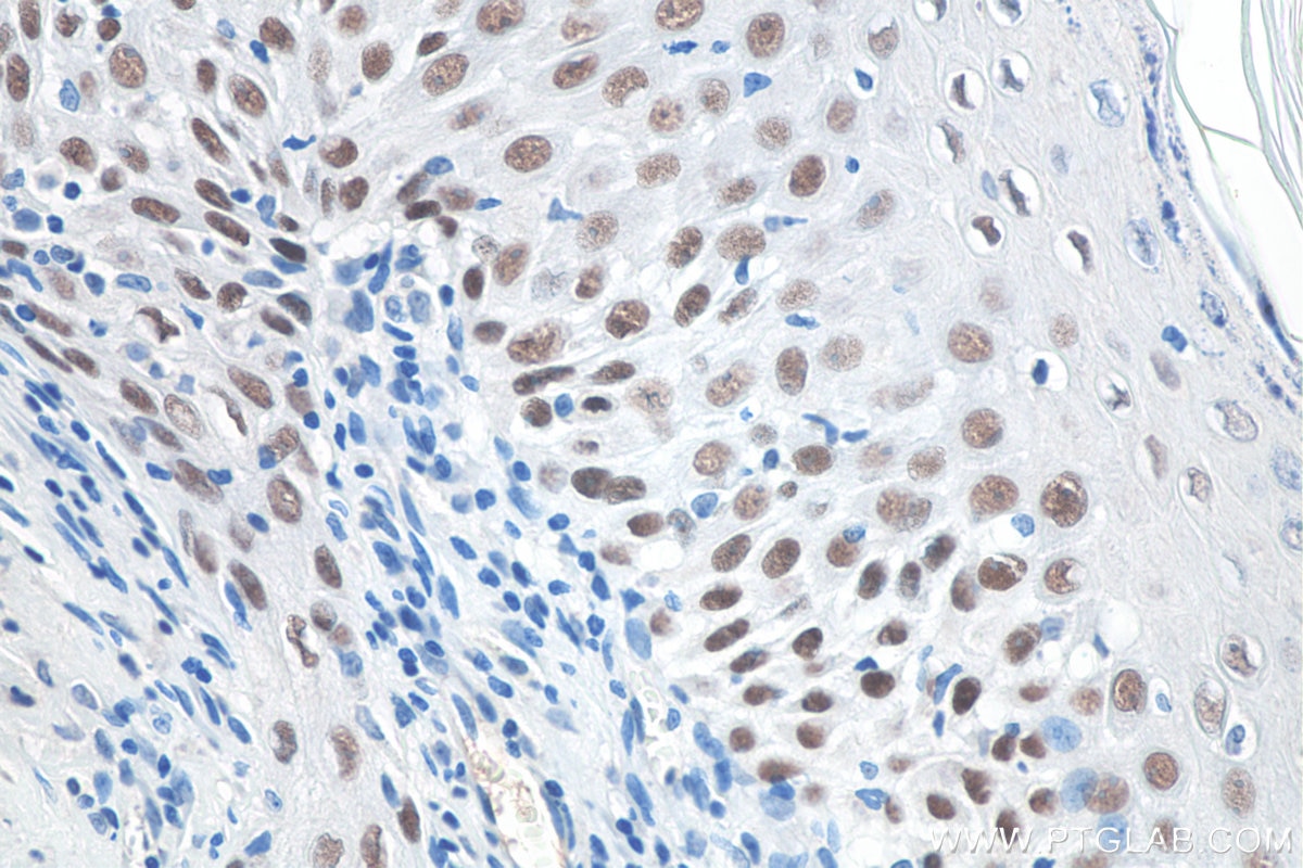 IHC staining of rat skin using 60332-2-Ig