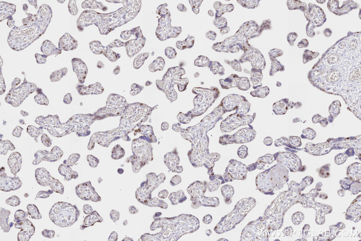 Immunohistochemistry (IHC) staining of human placenta tissue using p63 Monoclonal antibody (60332-2-Ig)