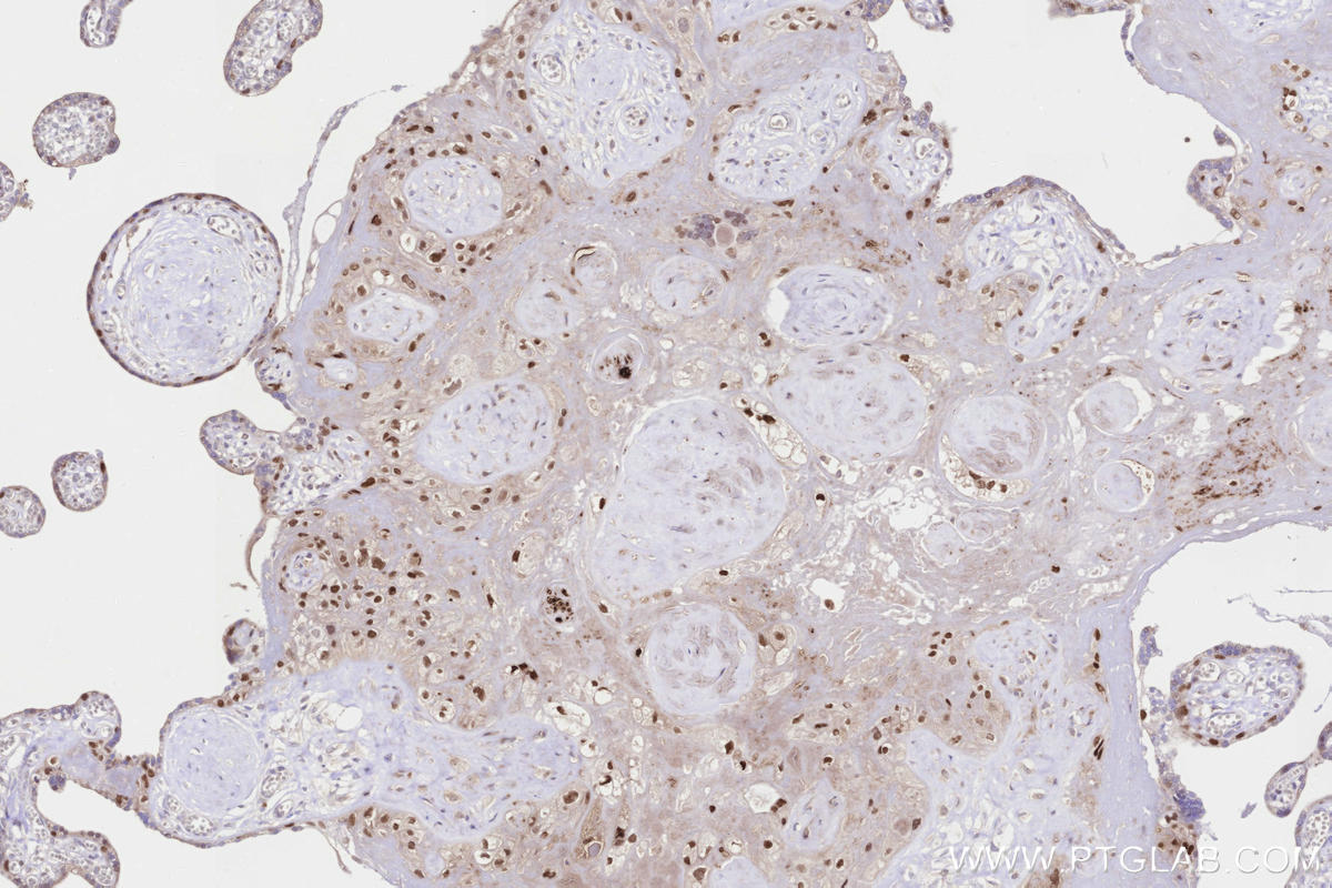 Immunohistochemistry (IHC) staining of human placenta tissue using p63 Monoclonal antibody (60332-2-Ig)