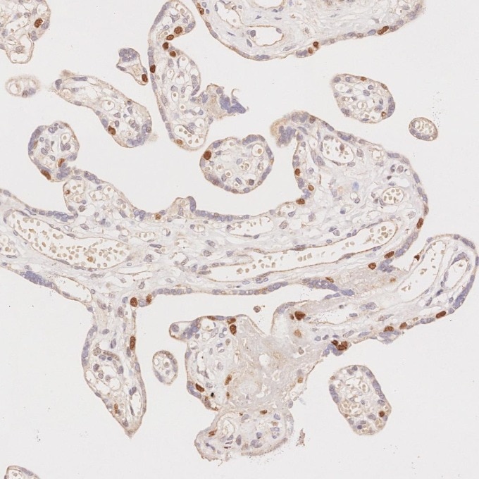 IHC staining of human placenta using 60332-2-Ig Immunohistochemistry (IHC) staining of human placenta tissue using p63 Monoclonal antibody (60332-2-Ig)