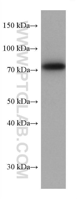 WB analysis of A431 using 60332-2-Ig