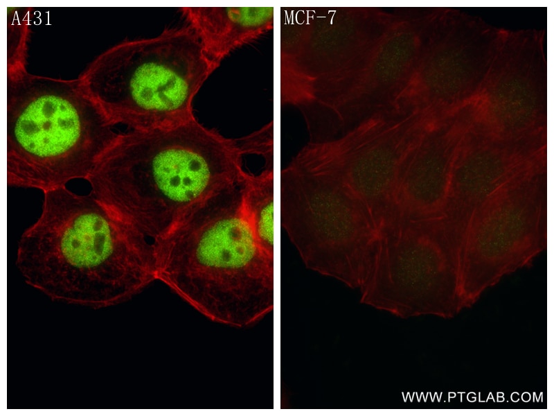 Immunofluorescence (IF) / fluorescent staining of MCF-7 cells using TP63 Recombinant monoclonal antibody (86154-1-RR)