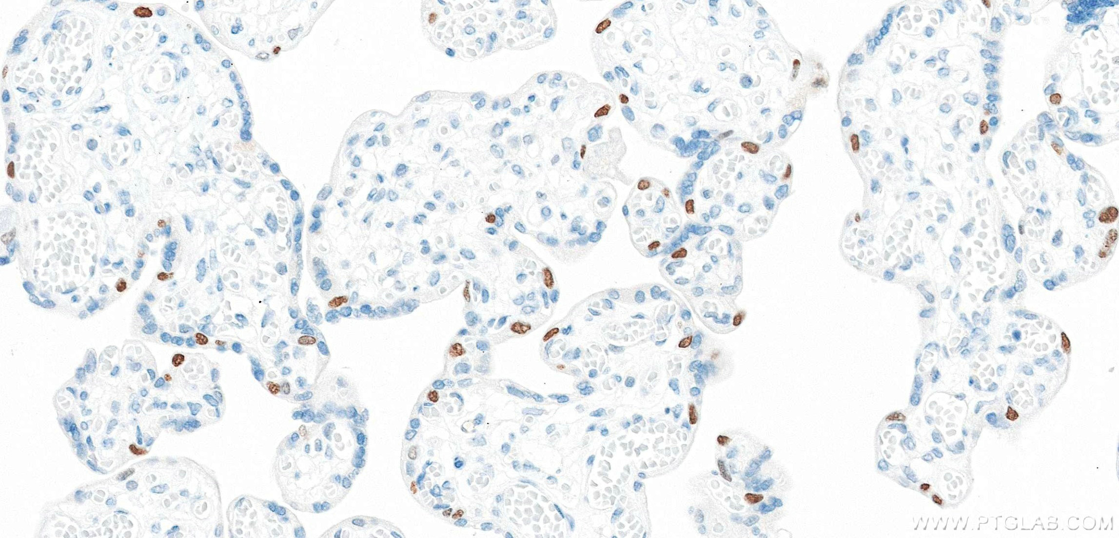 IHC staining of human placenta using 86154-1-RR Immunohistochemistry (IHC) staining of human placenta tissue using TP63 Recombinant monoclonal antibody (86154-1-RR)