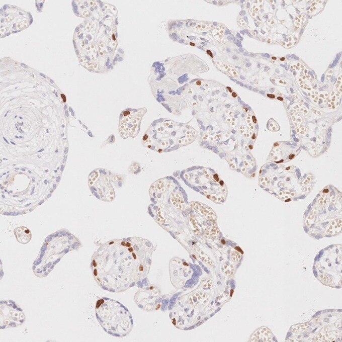IHC staining of human placenta using 86154-1-RR Immunohistochemistry (IHC) staining of human placenta tissue using TP63 Recombinant monoclonal antibody (86154-1-RR)