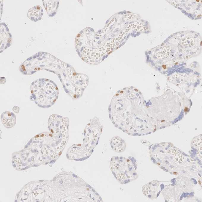IHC staining of human placenta using 86154-1-RR Immunohistochemistry (IHC) staining of human placenta tissue using TP63 Recombinant monoclonal antibody (86154-1-RR)