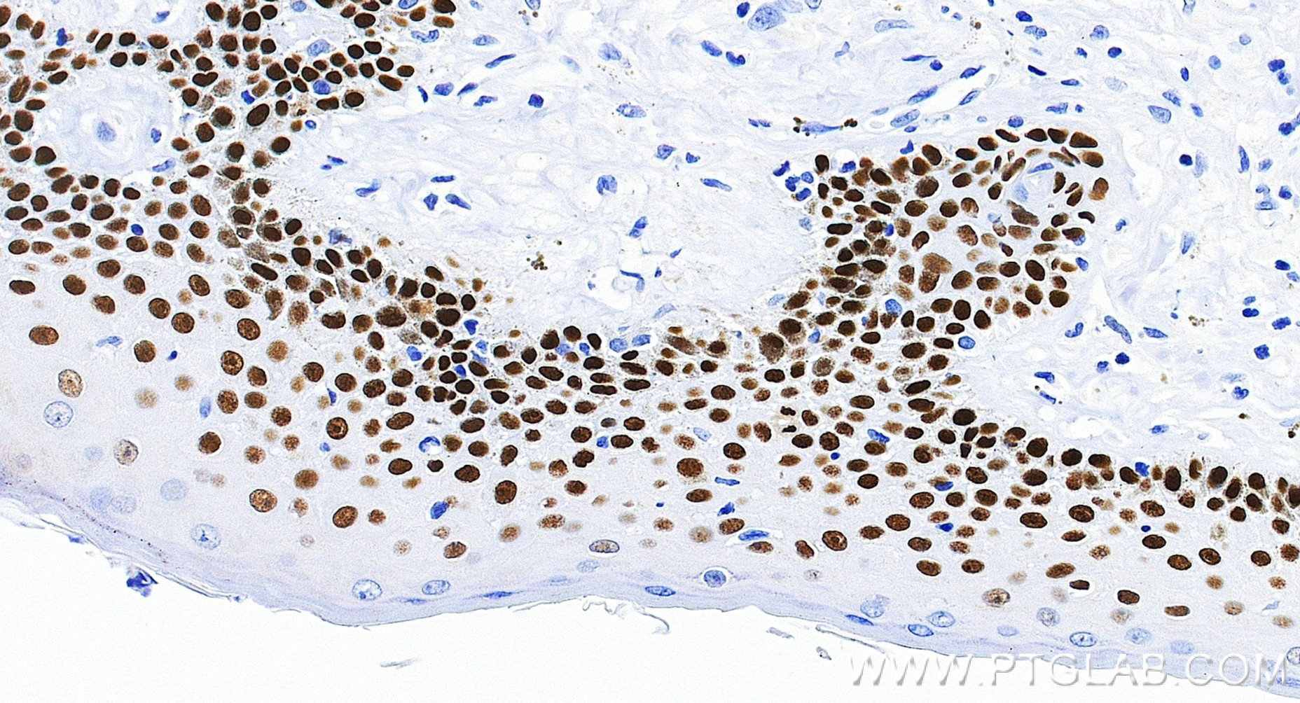 Immunohistochemistry (IHC) staining of human skin tissue using TP63 Recombinant monoclonal antibody (86154-1-RR)