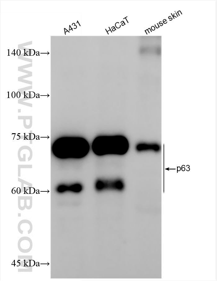 Western Blot (WB) analysis of various lysates using TP63 Recombinant antibody (86154-1-RR)