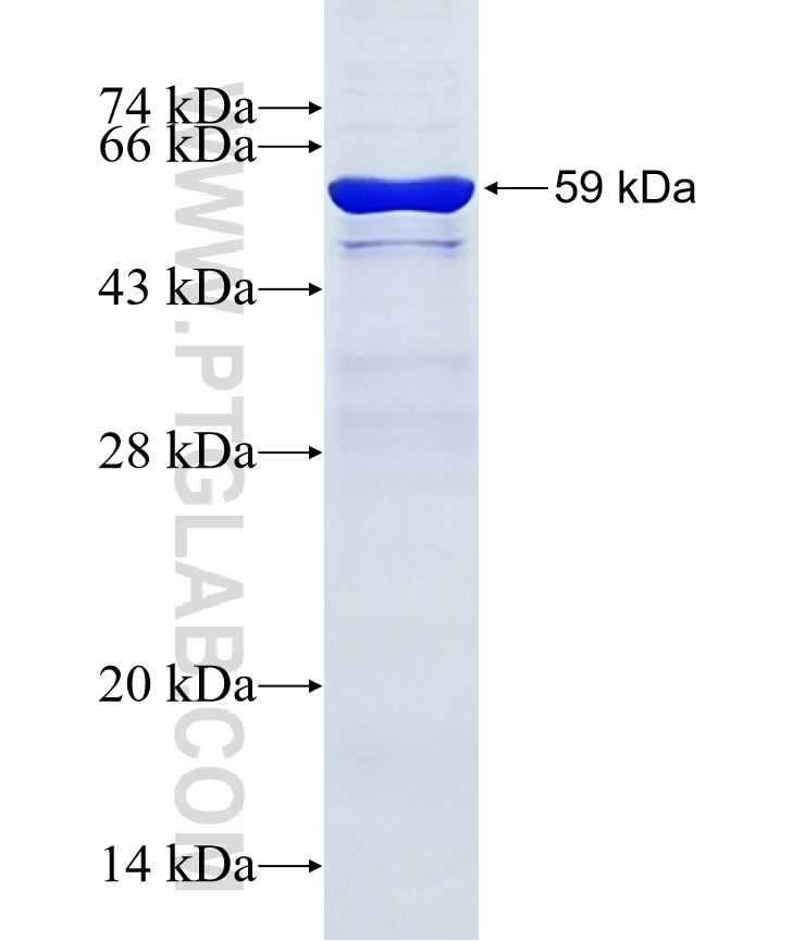 TP63 fusion protein Ag2791 SDS-PAGE