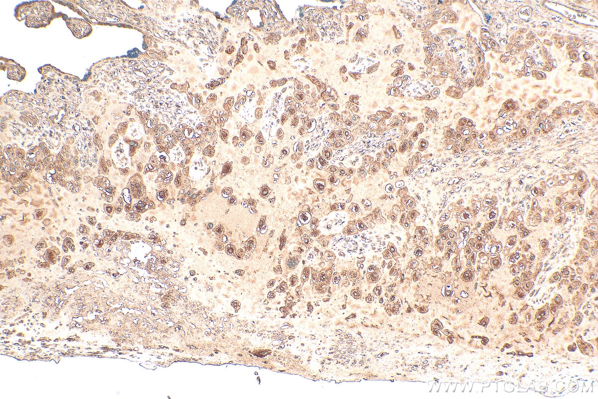 Immunohistochemistry (IHC) staining of human placenta tissue using TP73 Polyclonal antibody (27688-1-AP)