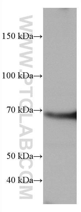 Western Blot (WB) analysis of HeLa cells using TP73 Monoclonal antibody (66990-1-Ig)