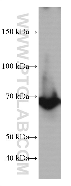 Western Blot (WB) analysis of HEK-293 cells using TP73 Monoclonal antibody (66990-1-Ig)