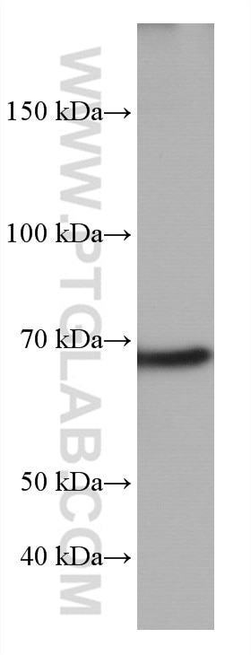 Western Blot (WB) analysis of MCF-7 cells using TP73 Monoclonal antibody (66990-1-Ig)