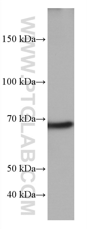 WB analysis of MCF-7 using 66990-1-Ig