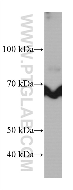 Western Blot (WB) analysis of Jurkat cells using TP73 Monoclonal antibody (66990-1-Ig)