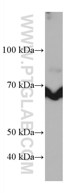 WB analysis of Jurkat using 66990-1-Ig