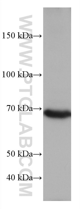 Western Blot (WB) analysis of HSC-T6 cells using TP73 Monoclonal antibody (66990-1-Ig)