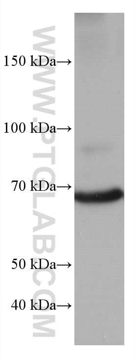 Western Blot (WB) analysis of NIH/3T3 cells using TP73 Monoclonal antibody (66990-1-Ig)
