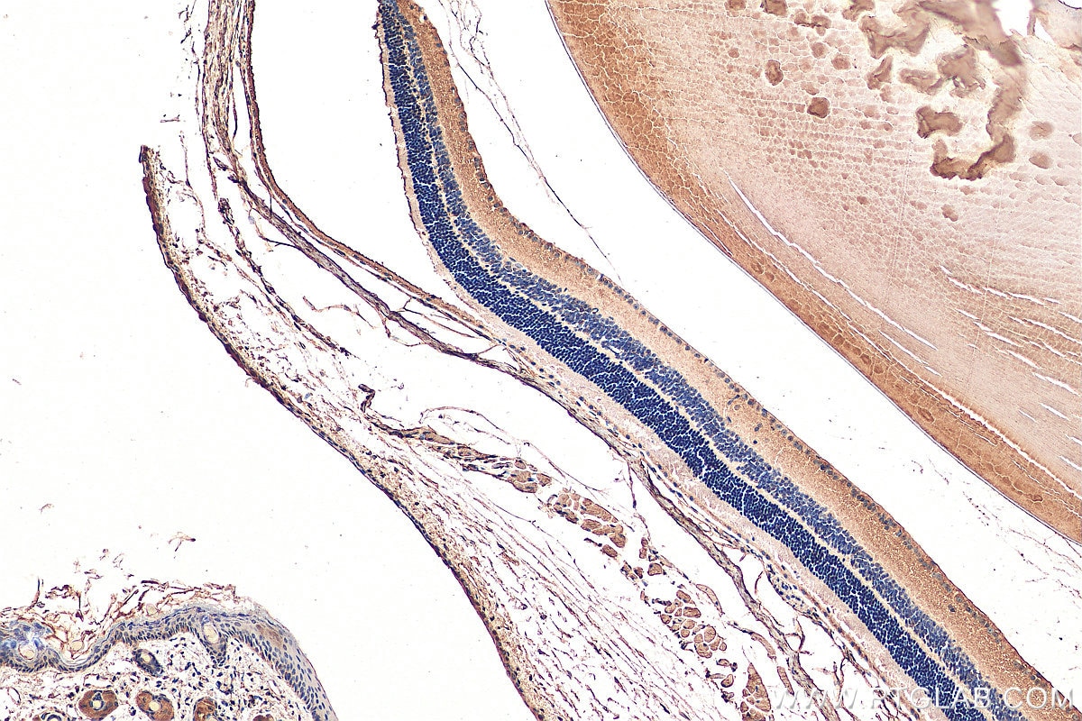 Immunohistochemistry (IHC) staining of mouse eye tissue using TPBG Polyclonal antibody (29394-1-AP)