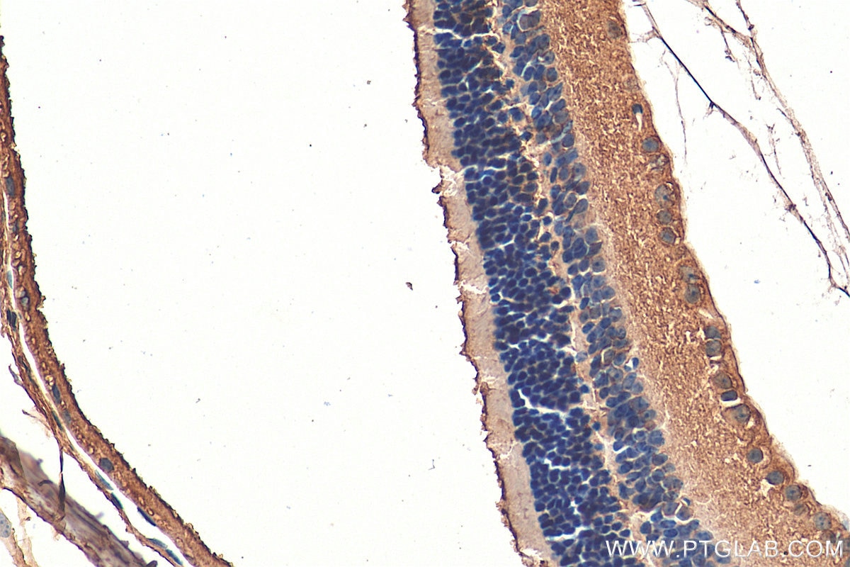 Immunohistochemistry (IHC) staining of mouse eye tissue using TPBG Polyclonal antibody (29394-1-AP)