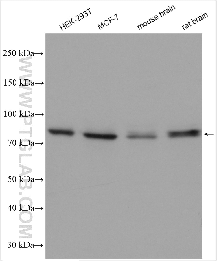 Western Blot (WB) analysis of various lysates using TPBG Polyclonal antibody (29394-1-AP)